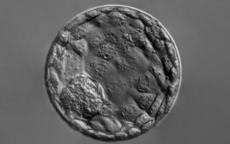 Blastocyst IVF