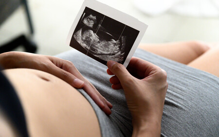 Graviditetsscanning Aagaard Klinik
