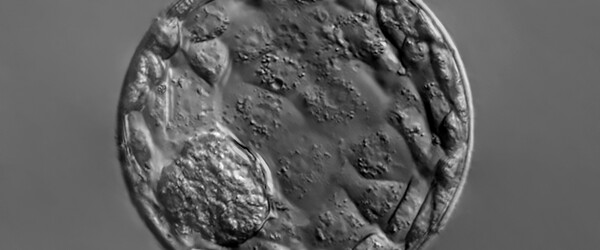Blastocyst IVF
